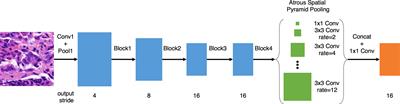 Clinical-grade endometrial cancer detection system via whole-slide images using deep learning